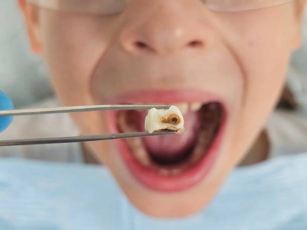 Best Cosmetic Emergency Dentistry in Weston, MO